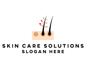 Hair Follicle Removal logo design