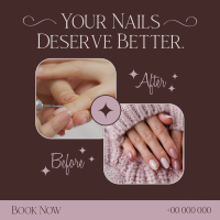 Nail Before and After Instagram Post Design