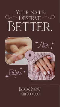 Nail Before and After Instagram Story