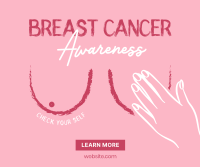 Breast Cancer Facebook Post example 4