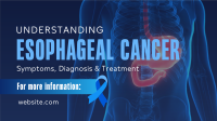 Esophageal Cancer Awareness Animation
