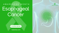Esophageal Cancer Awareness Animation