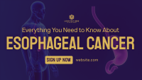 Esophageal Cancer Webinar Animation