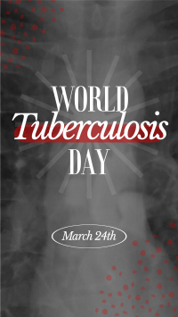 World Tuberculosis Day Instagram Reel