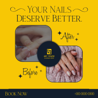 Nail Before and After Instagram Post Image Preview