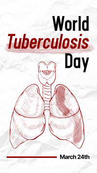 Tuberculosis Day Video