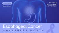 Esophageal Cancer Awareness Animation