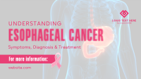 Esophageal Cancer Awareness Animation